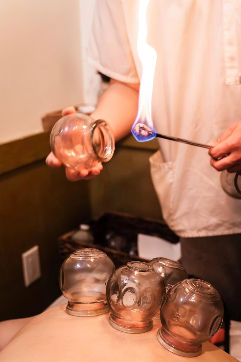 Preparing a glass cup with fire for cupping therapy