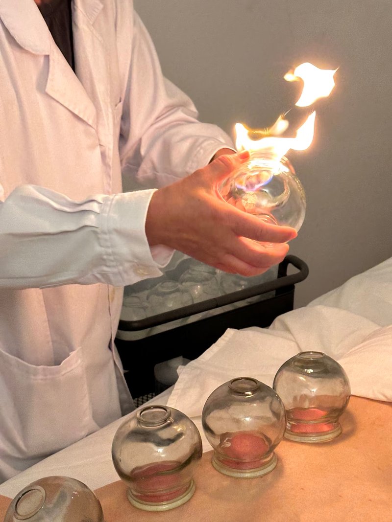 Close-up of flame used to create suction in a cupping jar